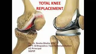 Total Knee Replacement (TKR) #StayHome and study #WithMe