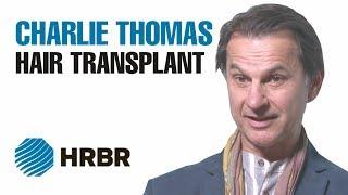 Charlie Thomas Hair Transplant Testimonial - HRBR - Hair Restoration Blackrock