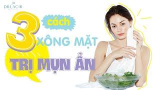 3 CÁCH XÔNG MẶT TRỊ MỤN ẨN TẠI NHÀ KHÔNG THỂ BỎ QUA