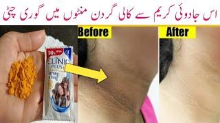 Skin care dailyEasy HomeRemedy forspotless bright glowing skin&depigmentatio |Ramadan Special 2024