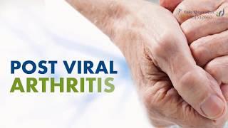 Post Viral Arthritis | Dr Dheeraj Kondagari | Endo Rheuma Care.