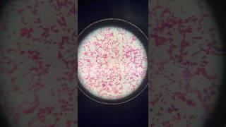 Structure of a Bacterial Cell: Gram Staining Method.  #shortsvideo #bacteria #meditation #medical