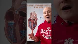 Pathophysiology of Right Ventricular Failure