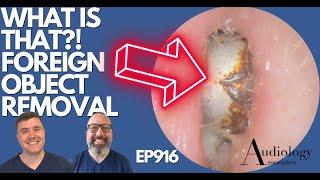 WHAT IS THAT?! FOREIGN OBJECT REMOVAL - EP916
