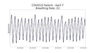 Non-contact health monitoring for COVID-19