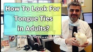 How To Look For Tongue Ties In Adults