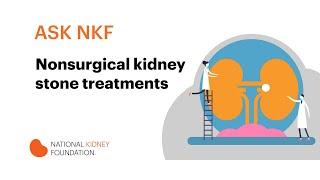 Nonsurgical kidney stone treatments | National Kidney Foundation