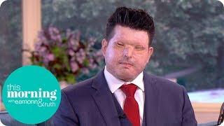 How Should You Respond to an Acid Attack? | This Morning