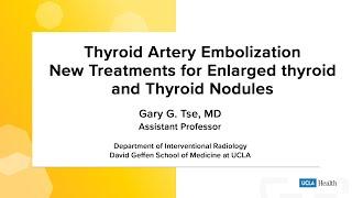 Thyroid Artery Embolization: New treatments for enlarged thyroid and thyroid nodules | UCLA Health