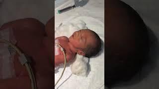 New born babies #medicalnursing #baby #pediatricnursing #bpharma #pharmacy #nursing #youtubeshorts #