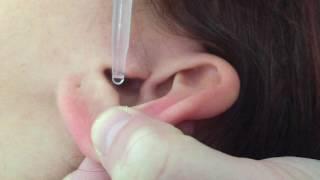 how to use ear drops