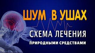  ШУМ В УШАХ. Лечение природными средствами.