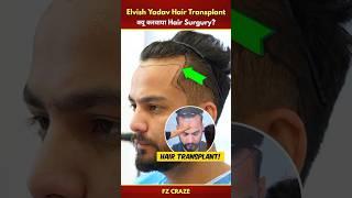 Elvish Yadav Hair Transplant Surgury Video | @ElvishYadavVlogs Hair Transplant #trending #shorts