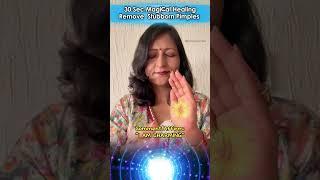 Reiki Healing To Remove Stubborn Pimple | Reiki Healing To Get Glass Skin | Healing For Beauty Eng