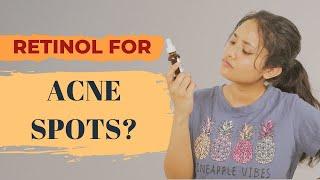 Can You Use Retinol for Acne Scars and Hyperpigmentation