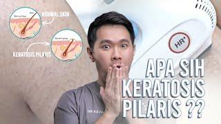 KERATOSIS PILARIS: TEKSTUR KULIT TUBUH YANG SEPERTI KULIT AYAM!