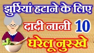 10 Home Remedies for Wrinkles on Face | दादी नानी घरेलू नुस्खे | Jurriyo ke Liye Gharelu Upay