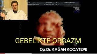 GEBELİKTE CİNSEL İLİŞKİDE ORGAZMDA OLUŞAN RAHİM KASILMALARI DÜŞÜK VE ERKEN DOĞUM RİSKİNİ ARTIRIR MI?