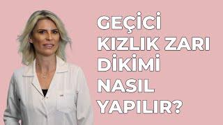 Geçici Kızlık Zarı Dikimi Nasıl Yapılır? - Jin. Op. Dr. Burcu K. Arslan