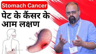 पेट के कैंसर के लक्षण ||  Stomach Cancer Cause, Symptoms, and Treatment || Dr. Zubin Dev Sharma