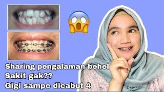 PENGALAMAN PASANG BEHEL | Harga, Proses sampe Hasil 