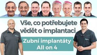 TOP dotazu o zubní implantaci All-on-X Jak probíhá implantace zubů?