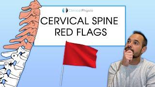 Cervical Spine Red Flags | Expert Physio Review