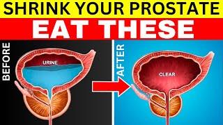 Say Goodbye to Prostate Problems with #1 Simple Nutrient