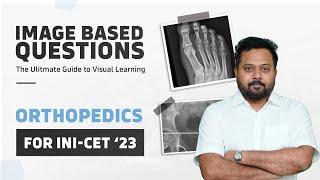 Important Images Of Orthopedics | Image Based Session for INI-CET by Dr. Jambukeswaran