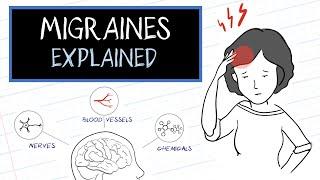 What are Migraines? (HealthSketch)