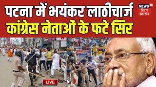 Bihar News Live: Patna में लाठीचार्ज, Congress नेताओं के फटे सिर |Congress Vidhansabha Protest Live