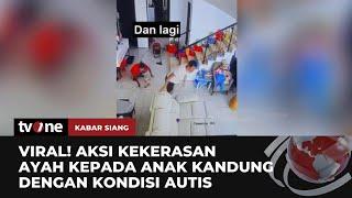 Pilu, Anak Berkebutuhan Khusus di Surabaya 8 Tahun Dianiaya Ayah | Kabar Siang tvOne