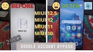 Xiaomi Redmi MIUI 12.5/12/11/10 Frp/Google Account Bypass|Without Pc|Without App|Latest Method|2022
