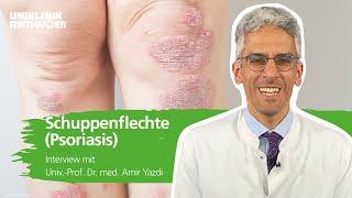 Schuppenflechte (Psoriasis): Prof. Yazdi steht Rede und Antwort