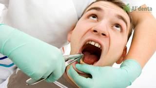 Хирургия в стоматологии. Комфортное удаление зубов без боли и страха. Сеть стоматологий "Al'denta".