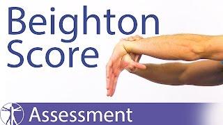 The Beighton Score | Generalized Joint Hypermobility (Laxity)