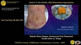 Robotic Rives Stoppa. Port placement & docking