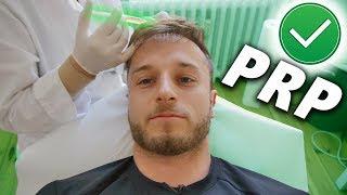 PRP Treatment for Hair Loss WORTH IT!? Experiences, Reults, Price