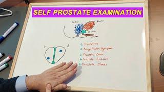 SELF EXAMINATION: PROSTATE CANCER, BPH OR PROSTATITIS? TOUCH YOUR PROSTATE TODAY
