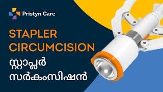 Circumcision treatment in Malayalam | Pristyn Care