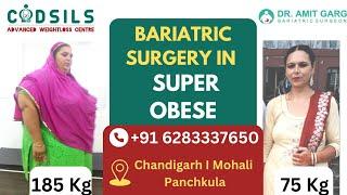 Mini gastric bypass in Punjab I Dr Amit Garg I Best surgeon for mini gastric bypass in Punjab