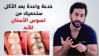 خدعة بعد الأكل ستحميك من تسوس الأسنان للأبد