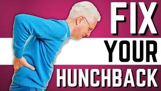 Top 10 Exercises to Stop Hunchback, Kyphosis, Forward Head Posture