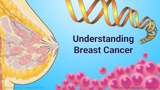 Understanding Breast Cancer