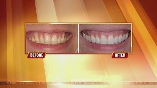 Get Rid Of Receding Gums! 6/1/15