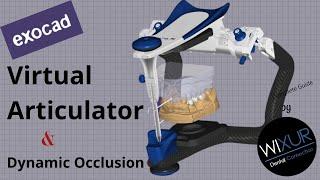 How to Use Virtual Articulator in exocad For Dynamic Occlusion