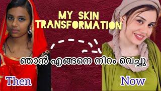 ഞാൻ എങ്ങനെ ഇത്രയും Change ആയി~my skin transformation~Jasmin Jaffar ️