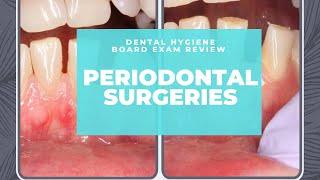 NBDHE - DENTAL HYGIENE BOARD EXAM REVIEW: Everything you need to know about Periodontal Surgeries