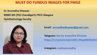 Must do Fundus images for FMGE