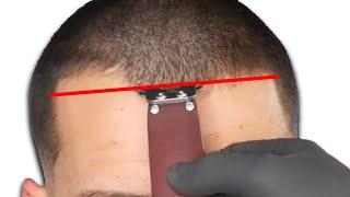 How To Line Up A Bad Hairline